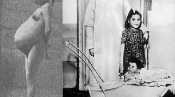 lina medina cea mai tanara mama din istorie a nascut la cinci ani