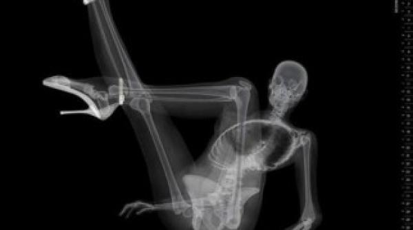 vezi aici cele mai sexy radiografii din toate timpurile