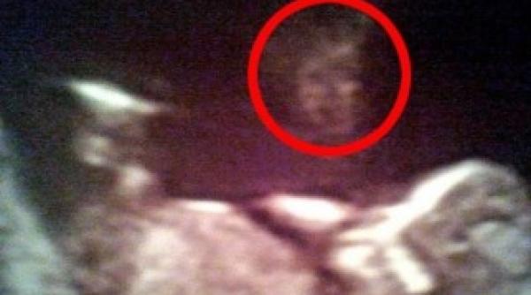ecografia care i a lasat pe parinti muti de uimire