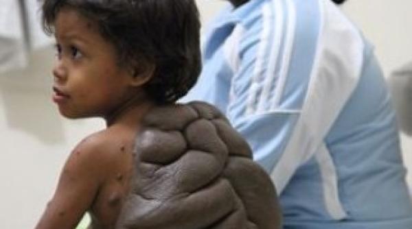 cum arata acest copil inainte sa fie operat galerie foto