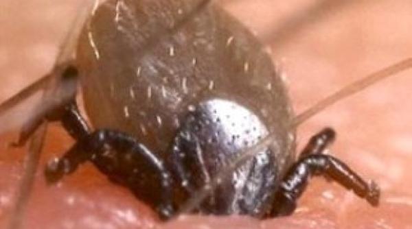 inamicul capuselor o bratara care costa doar 10 lei