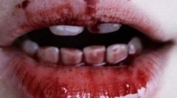 cum arata omul desfigurat de canibal in miami foto socant