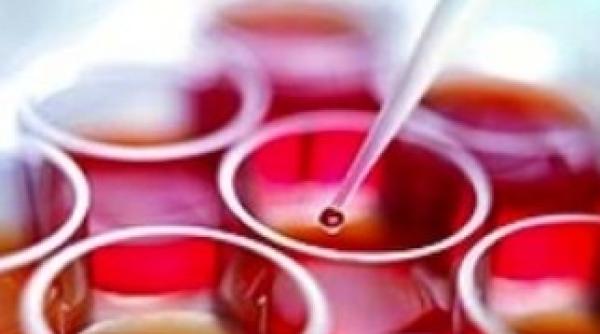 folosirea celulelor stem aprobata de parlamentul european