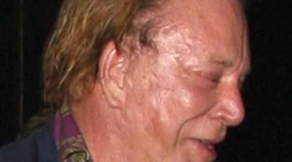 mickey rourke distrus de operatiile estetice
