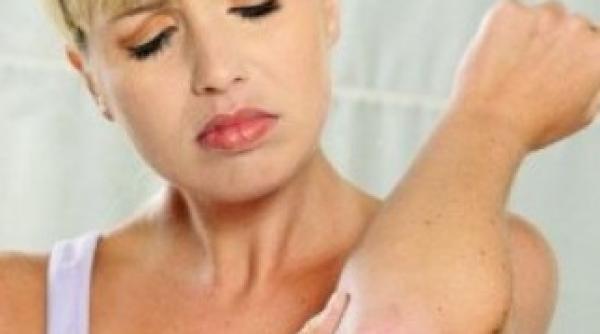 bolile de piele se inmultesc pe fondul crizei economice