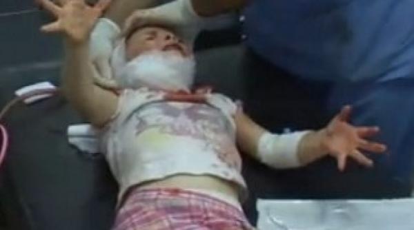 copil de 4 ani impuscat in cap in siria video