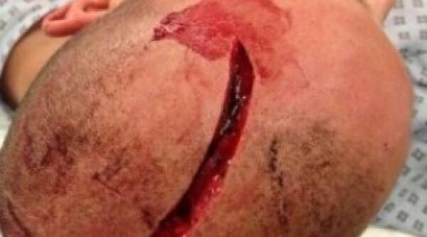 un suporter englez a fost masacrat de fanii lul lazio