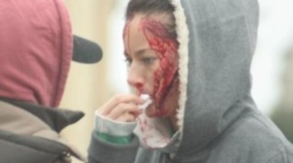 imagini terifiante cu laura cosoi vezi ce a patit artista