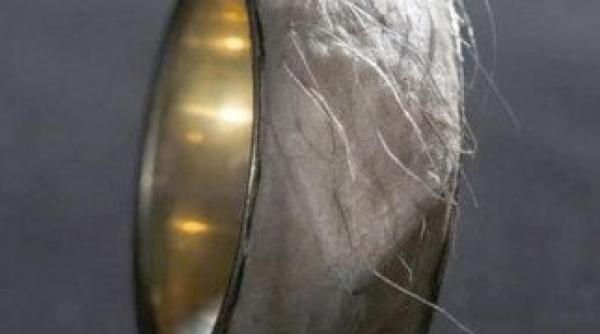 cum arata inelul din piele de om in valoare de 500 000 dolari