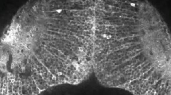 cum se formeaza gandurile in creier video