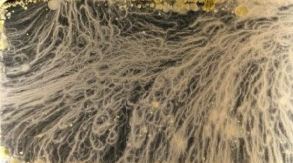 sigur iti vei dezinfecta telefonul mobil dupa ce vei vedea aceste imagini