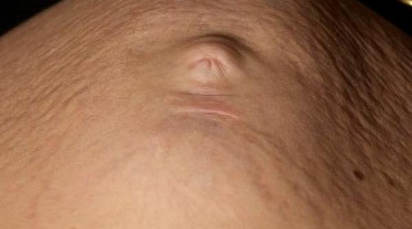 incredibil ce a aparut pe burta unei femei insarcinate