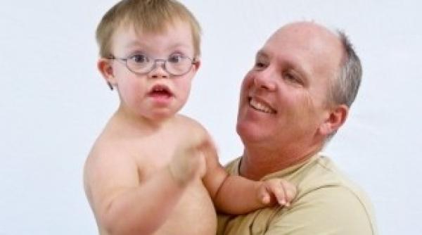 sindromul down poate fi tratat cu ajutorul unei proteine