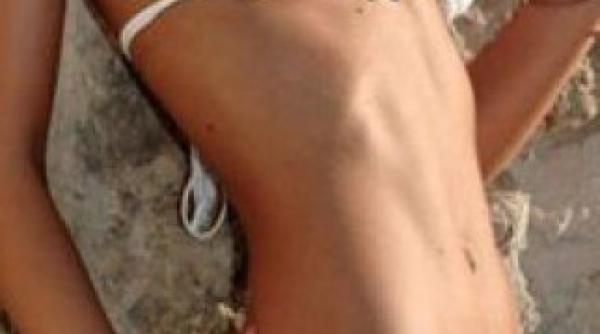 vezi care este alimentul care reduce grasimea de pe abdomen