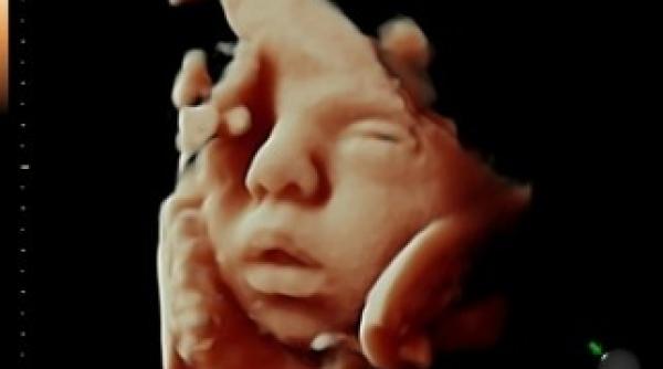 noua moda in ecografia fetala 3d si color