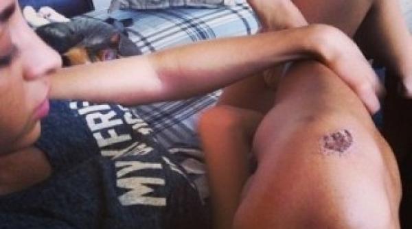 ruby cazatura in timpul unui concert vezi rana