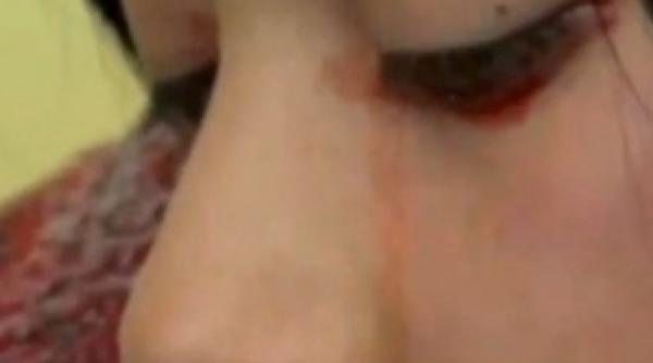 caz inexplicabil yaritza oliva plange cu lacrimi de sange video