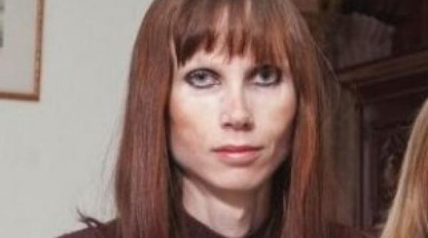cum a ajuns sa arate o femeie de 30 de ani din cauza anorexiei