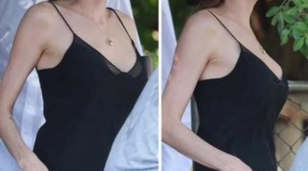 cum arata sanii angelinei jolie dupa dubla mastectomie