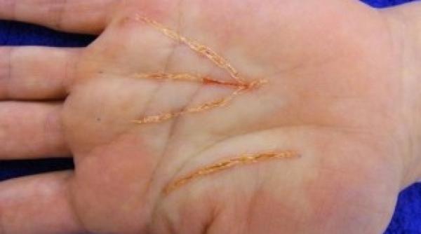 ochiul rosu este demodat ce fac mai nou japonezii