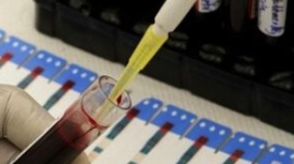 test de sange pentru descoperirea autismului la copii de varsta de un an