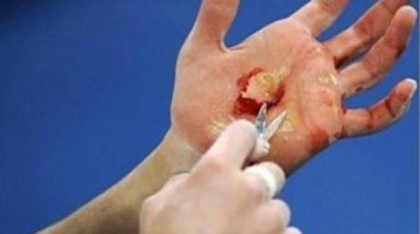 imaginea dura postata de o fosta gimnasta romanca