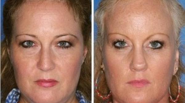 experiment cu gemeni efectul dezastruos al fumatul asupra fetei foto