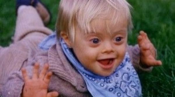 riscul sindromului down va fi depistat printr un nou test