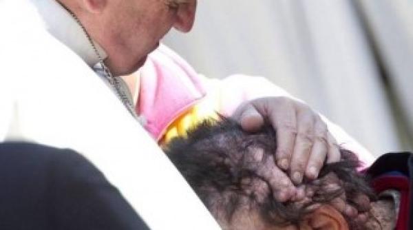 papa binecuvanteaza un om desfigurat de o boala rara fotografii impresionante