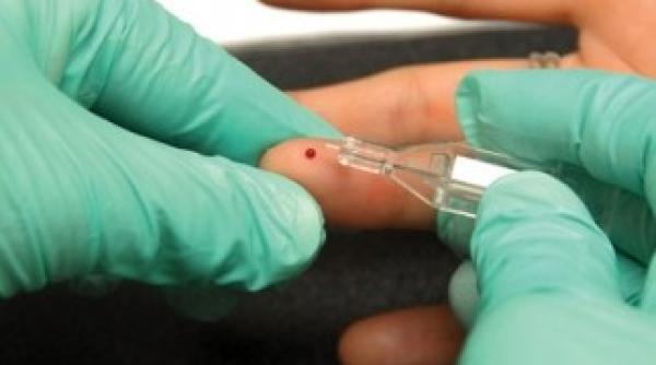 descoperire inedita alzheimer si diabetul tip 2 aceeasi boala