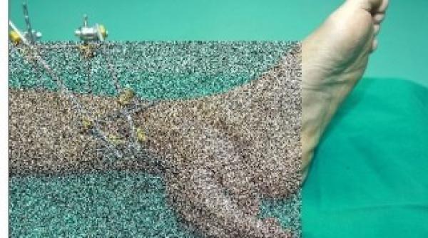 caz socant lumea medicala ce parte corpului fost lipita de picior