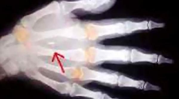 microcip obligatoriu pentru nou nascuti din 2014