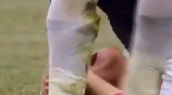 accidentare ingrozitoare liga 1 vezi imagini care te vor soca