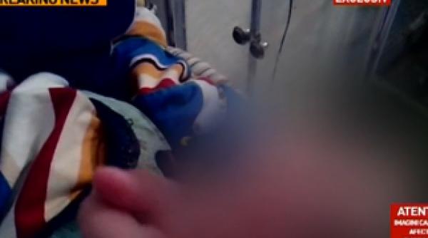 imagini de cosmar dintr un spital copil supus unui tratament inuman