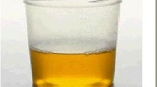 doi tineri despre calitatile urinei beau o ceasca sau doua pe zi