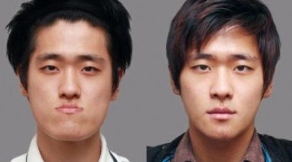 chirurgia estetica din coreea de sud intrece orice limita