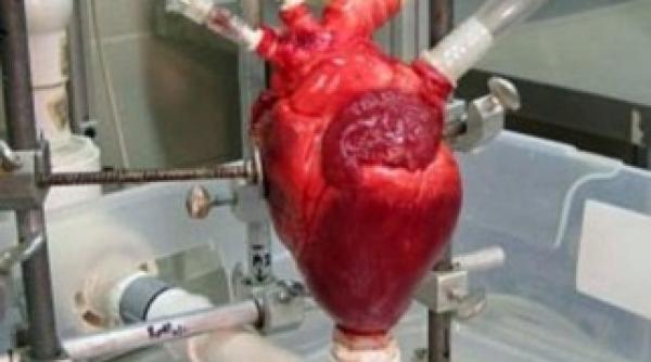 cum poate creste riscul de infarct colesterolul bun