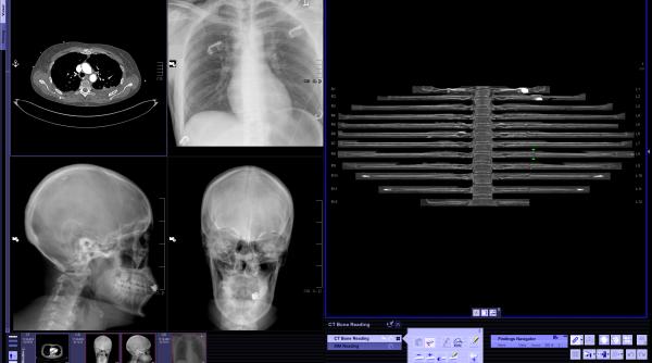 computerul rezolva criza de medici radiologi