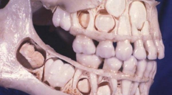 imagine ocanta despre care mul i au crezut ca este trucata