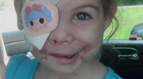 inuman ce a pa it aceasta feti a dupa ce a fost mu cata de pitbulli