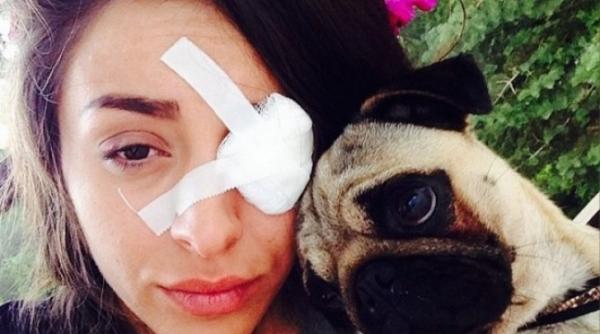 ruby accident terifiant mi a pus ochi de sticla foto