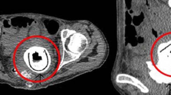 a stat 10 ai cu o jucarie sexuala in ea fara sa tie