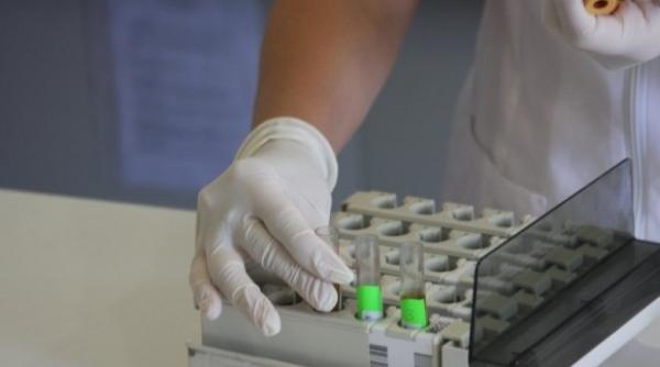 cat de periculoasa este mu catura de capu e afacerea borelioza vanzarea de speran e pe bani grei