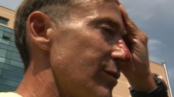 radu mazare cu fa a plina de sange foto