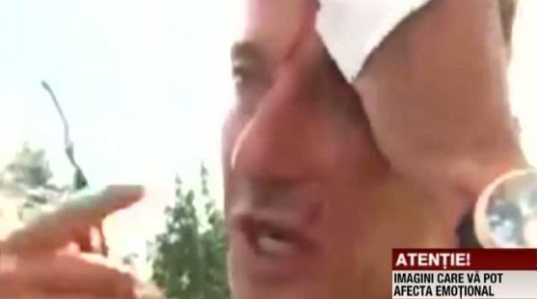 radu mazare s a lovit la cap nu moare nimeni
