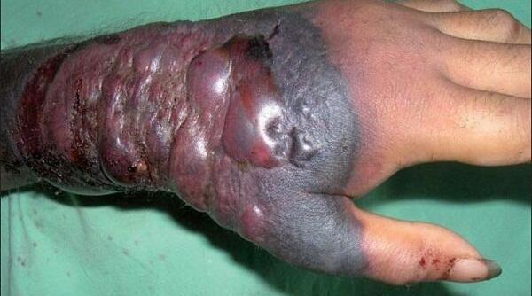 oms avertizeaza ebola se poate extinde