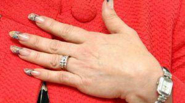 poliartrita reumatoida cea mai frecventa boala reumatica de tip inflamator