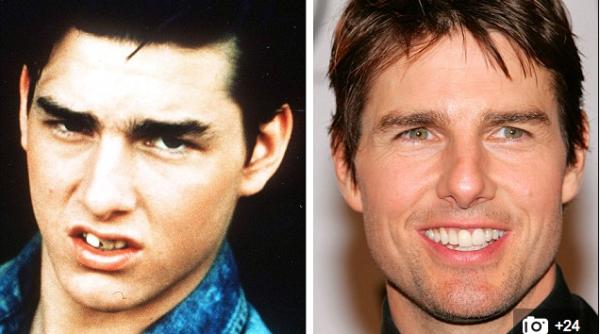 galerie foto inainte i dupa cum aratau vedetele inainte sa i repare din ii