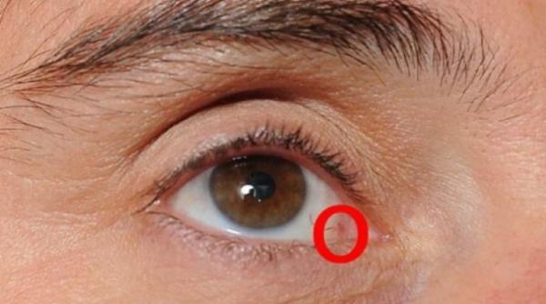 boala alzheimer se poate citi in ochi