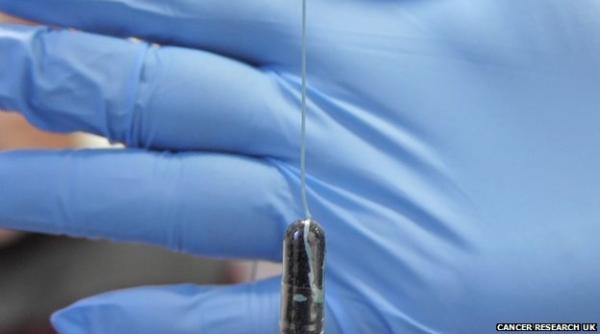 cancer de esofag diagnosticat rapid cu ajutorul unui burete